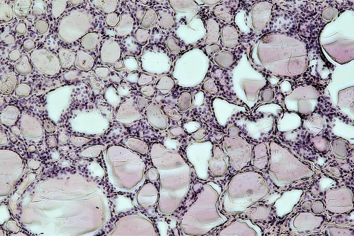 Microscope slide of thyroid follicles filled with colloid